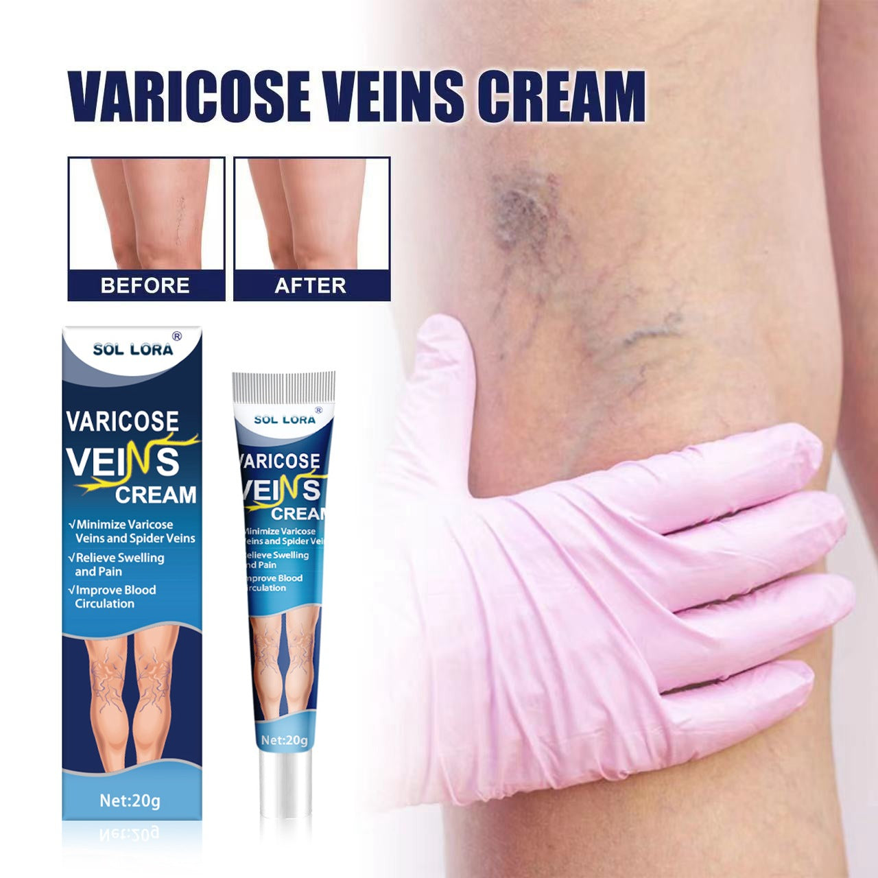 Cremă pentru Varice – Calm și Confort pentru Picioare